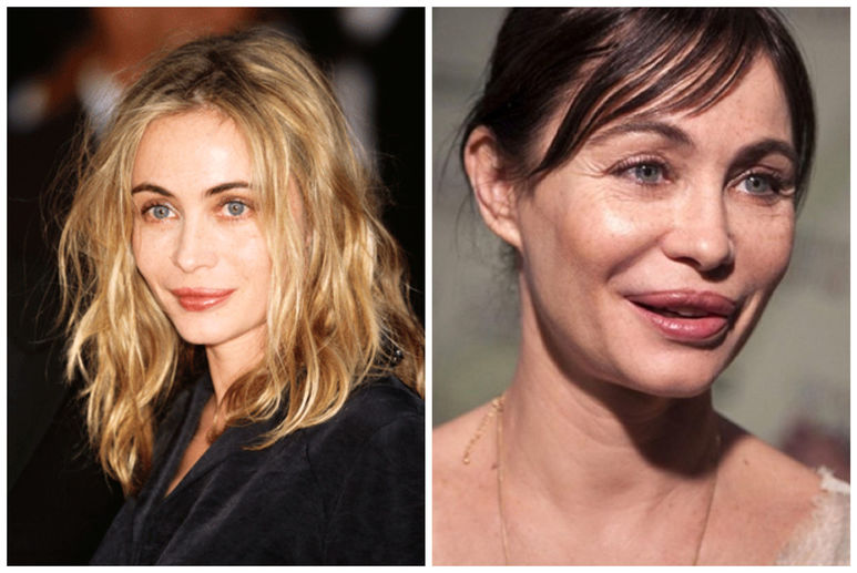 Эммануэль Беар